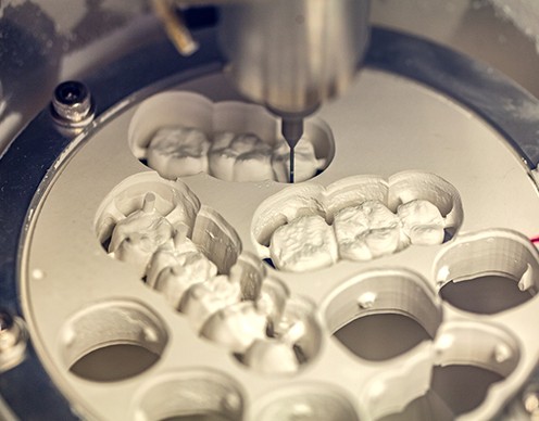 Zirconia bridges being crafted using in office milling unit