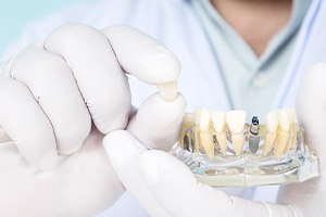 White-gloved hands holding model lower arch with sample implant with a dental crown between their thumb and forefinger