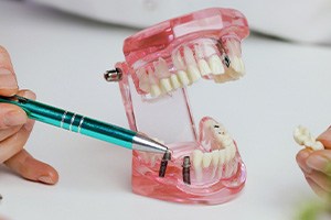 Hands of dentist pointing to sample jaw with 2 dental implants while holding a model dental bridge in the other hand