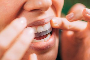 Nose-to-chin closeup of someone applying whitening strip to their upper arch