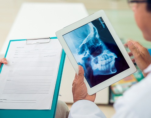 Digital x-rays of jaw and skull bone