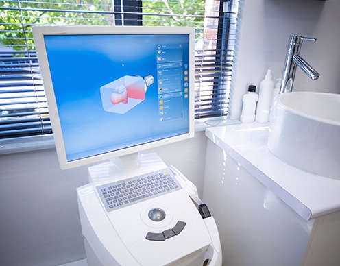 CEREC digital smile design on chairside computer