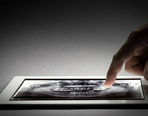 Digital x-rays on tablet computer