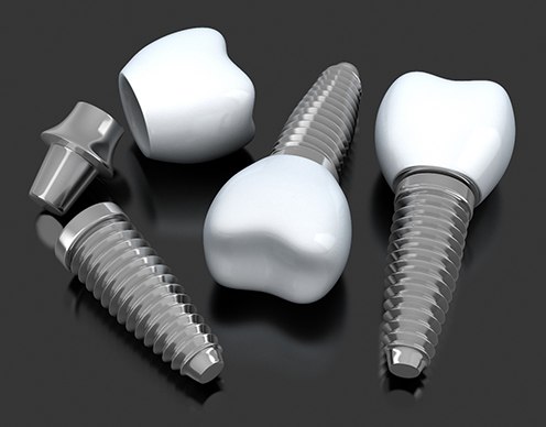 Model mini dentla implants in Randolph on black background