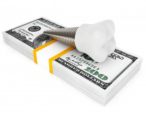 Model implant and money stack respresenting the cost of dental implants in Randolph