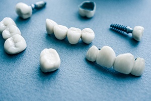 Types of dental implants in Randolph on blue background