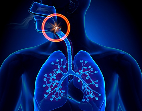 Animated obstructed airway