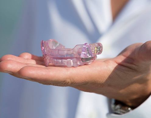 Hand holding sleep apnea oral appliance