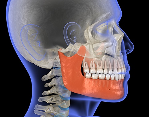 3 D rendering of patient's jaw and skull used for T M J therapy plans