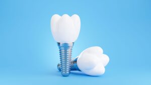 Two model dental implants in front of a light blue background